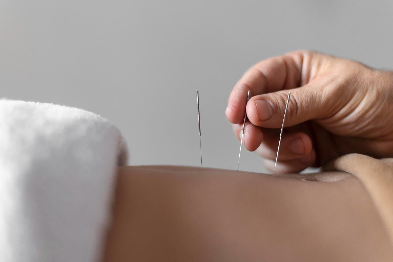 Acupuncture Clinic for Digestive Health in Tambaram