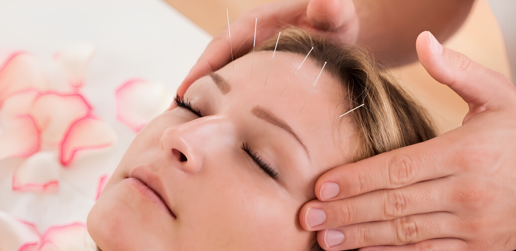 Acupuncture Clinic for Mental Wellness in Tambaram